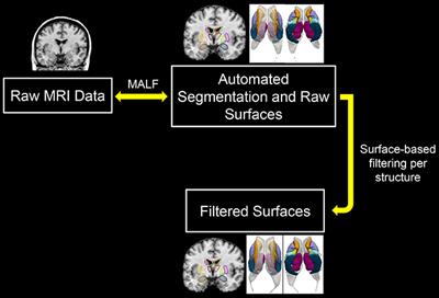 A Fully-Automated Subcortical and Ventricular Shape Generation Pipeline Preserving Smoothness and Anatomical Topology